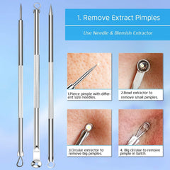 RKPM HOMES Blackhead Remover | Pimple Comedown Extractor Tool with Case | Whitehead Popping | Treatment for Blemish | Zit Removing for Nose Face Skin | Remover Tools Kit - Set of 4