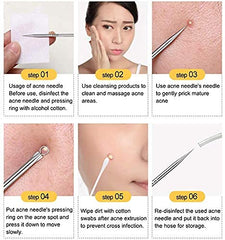 RKPM HOMES Blackhead Remover | Pimple Comedown Extractor Tool with Case | Whitehead Popping | Treatment for Blemish | Zit Removing for Nose Face Skin | Remover Tools Kit - Set of 4